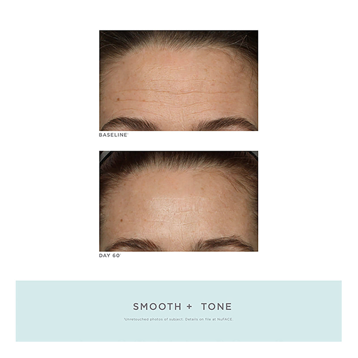 Trinity Facial Toning Device + Wrinkle Reducer Attachment Bundle N5993