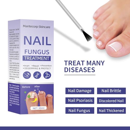 Toenail Fungus Treatment Extra Strength 30ml J2444